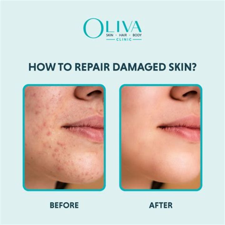 Can you use O Keeffe's skin repair on your face?