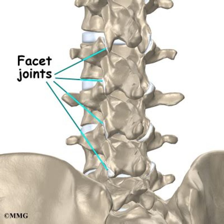Does s1 have a facet joint?