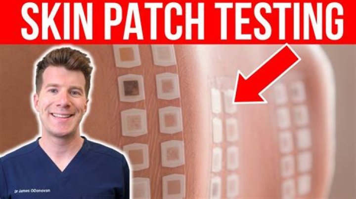How do you do the patch test?