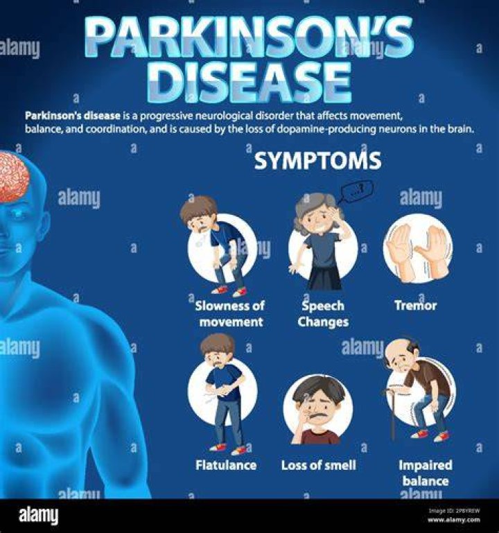 What actor died of Parkinson's disease?