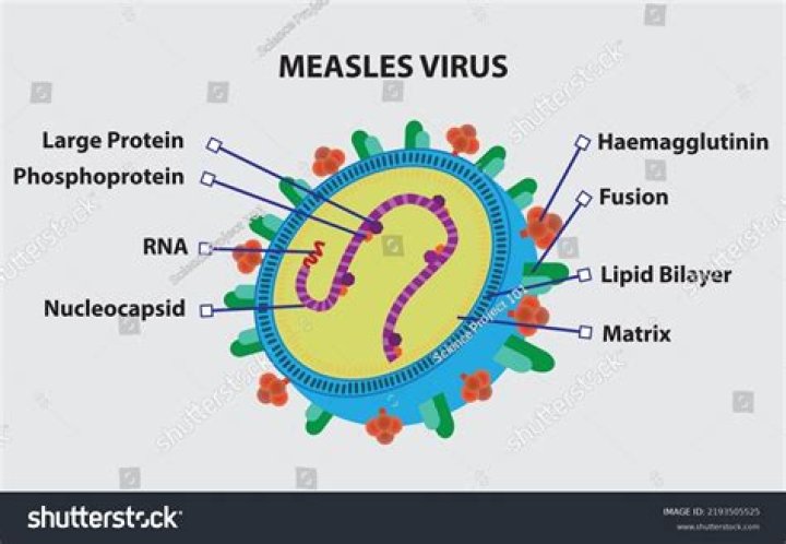 What type of virus is measles?